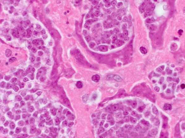 Ricerca sui parassiti in una persona