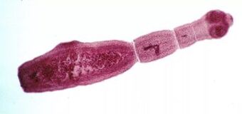 Come sbarazzarsi dei parassiti nel corpo umano