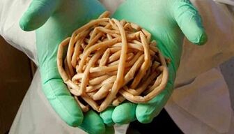 Metodi per eliminare i parassiti dal corpo