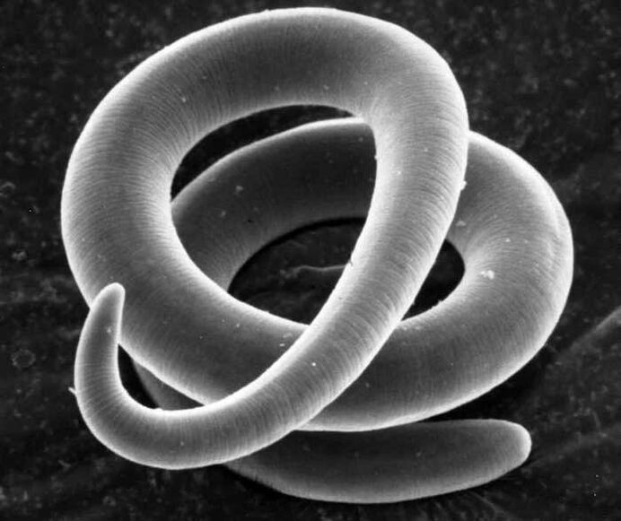 Trichinella al microscopio
